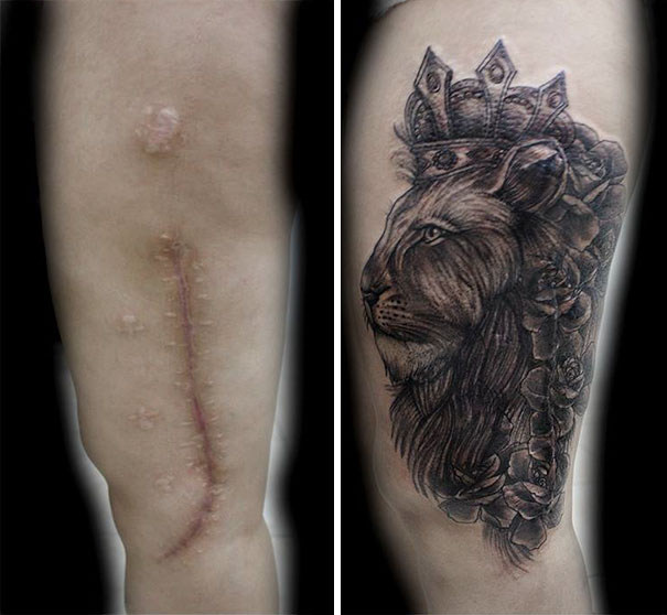Перекрытие шрамов татуировкой на руке для мужчин
